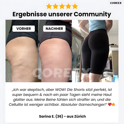 COREEX CelluFlex™ 3D-Kompressionsshorts